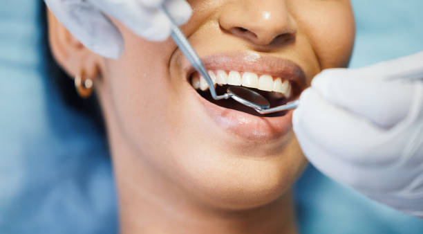 Best Teeth Whitening  in Fountain, CO