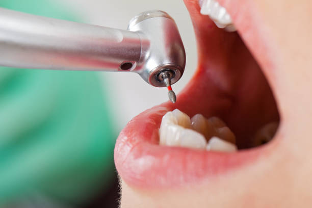 Emergency Gum Pain Relief in CO